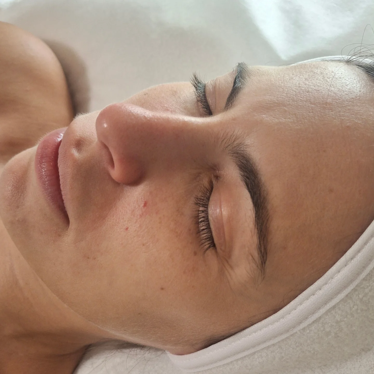 Calm, post-facial skin